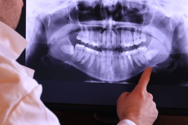 Best Emergency Dentist for Knocked-Out Tooth in St Matthews, SC